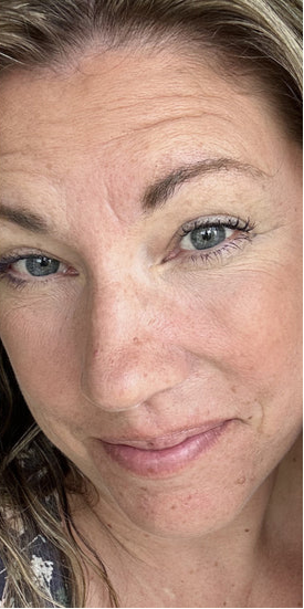 files/woman_eye_massage.png